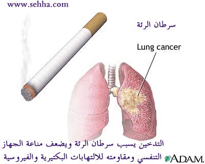 اخطار التدخين Attachment